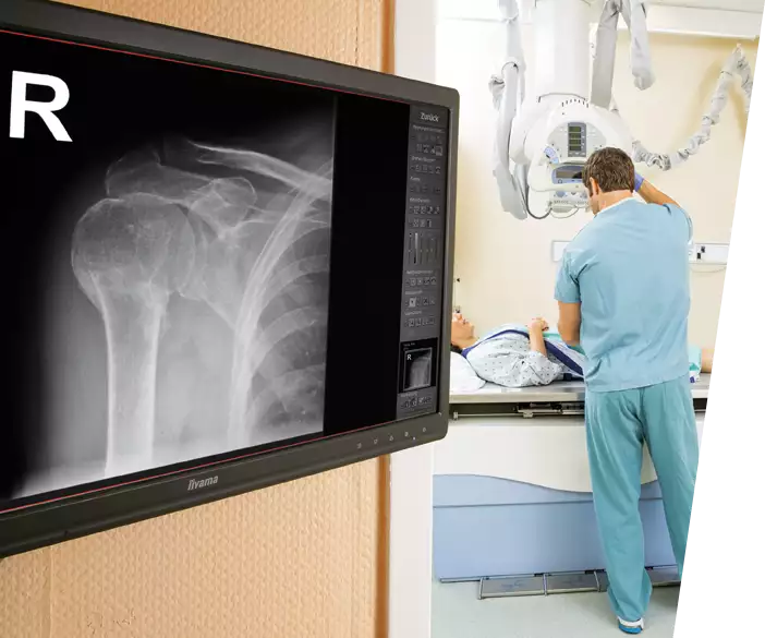 Medici - Digital X-ray retrofit kit for existing medical X ray units