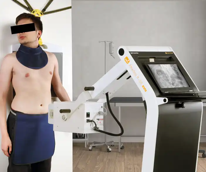 Amadeo M-DR mini - unidad móvil de rayos X para exámenes de cuerpo a cuerpo