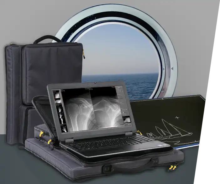  Leonardo DR nano: sistema de rayos X ligero como solución de mochila para su enfermería