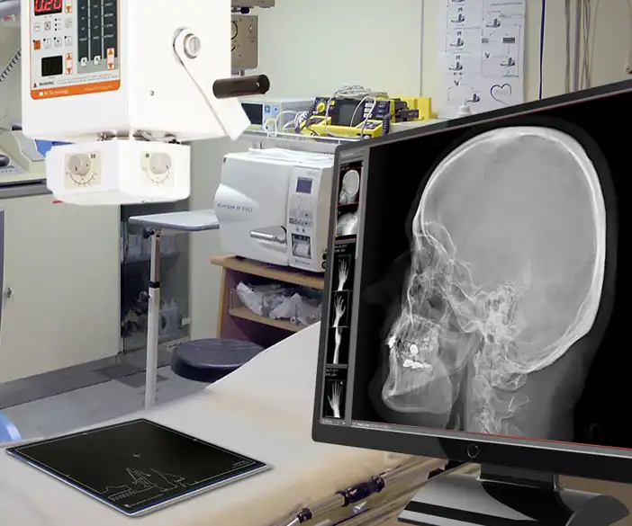 Medici - Nachrüst-Set um bestehende, humanmedizinische, tragbare Röntgengeräte zu digitalisieren