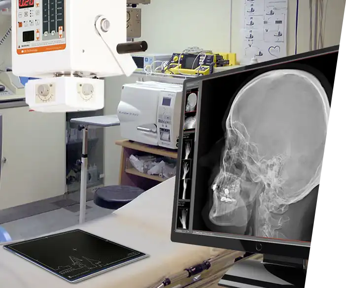 Medici - Digitales Röntgen Nachrüst-Set für bestehende, humanmedizinische Röntgengeräte