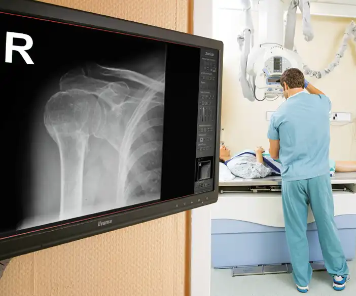 Medici - Kit de adaptación digital para la digitalización de unidades de rayos X antiguas y analógicas