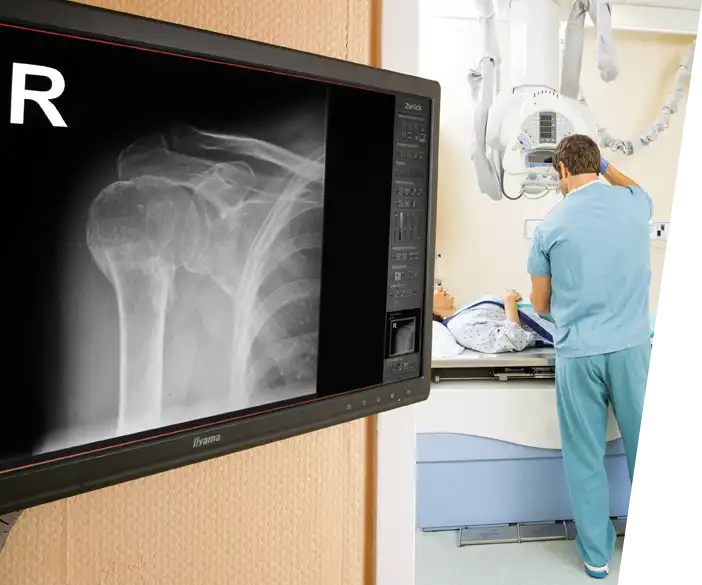 Medici - Set de retrofit de rayos X digital para digitalizar los equipos de rayos X analógicos existentes a bordo