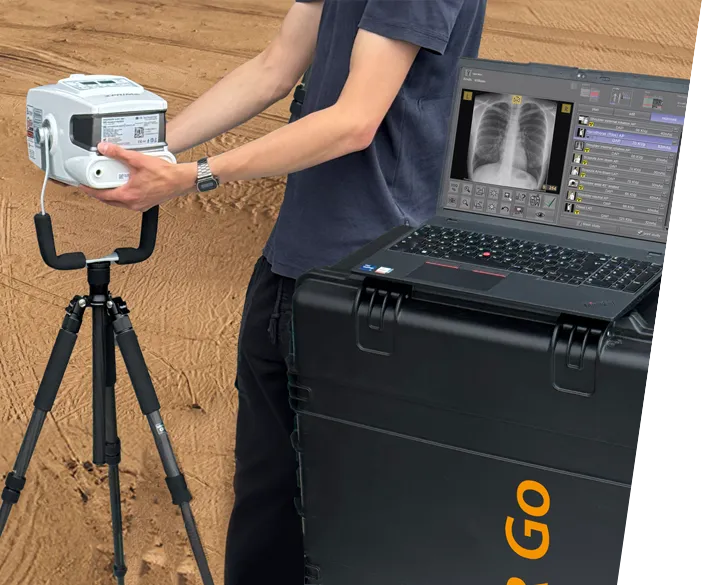 Leonardo DR go - mobile, kleine Röntgenanlage