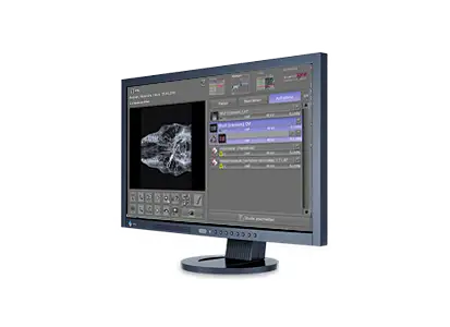 Acquisition and diagnostic software for X-ray images 