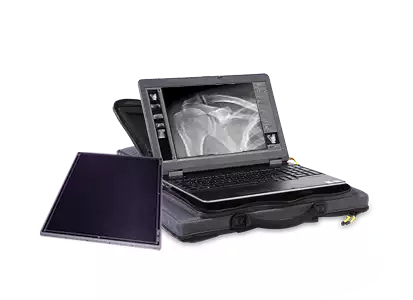 Superlight, portable X ray system for digital radiography as backpack solution
