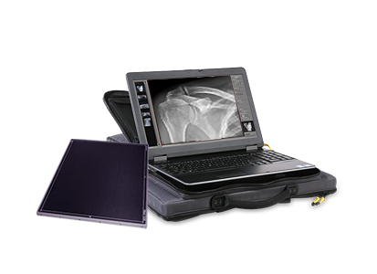 Leonardo DR nano: Ultra lightweight, portable X-ray system for digital radiography in a backpack 