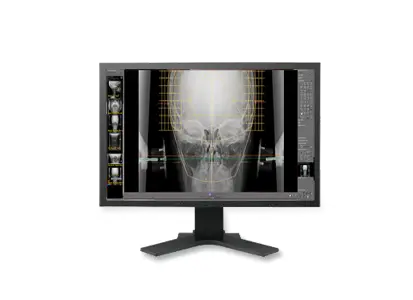 PACS Diagnostic tools for optimal chiropractical treatment and NUCCA