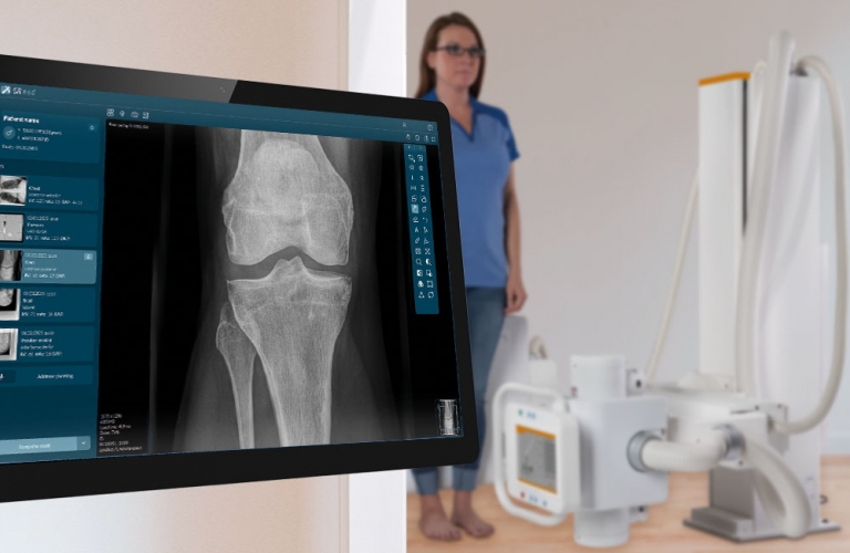 leistungsfähige Röntgen-Akquisitionssoftware