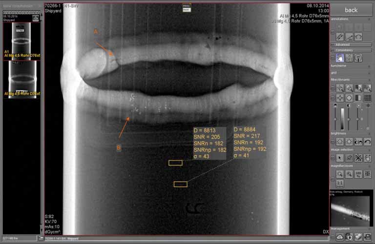 Allows the evaluation of radiographic within the acquisition software and offers numerous tools (e.g. SNR measurement/ SNRN determination) the creation of standard-compliant inspection reports.