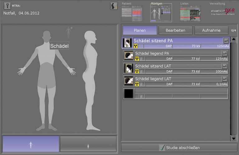 Akquisitions-Befundsoftware-Roentgenbilder-human-1-DE