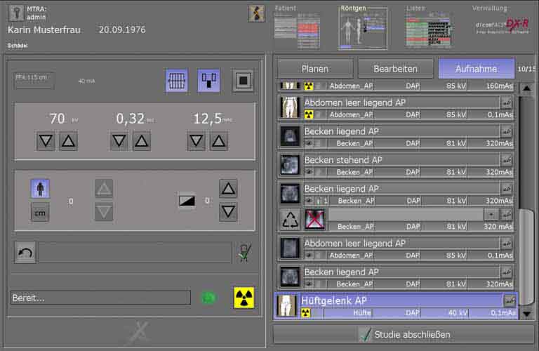 Akquisitions-Befundsoftware-Roentgenbilder-human-2-DE