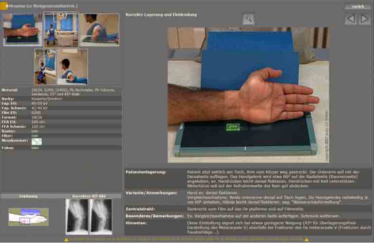 Akquisitions-Befundsoftware-Roentgenbilder-human-3-DE