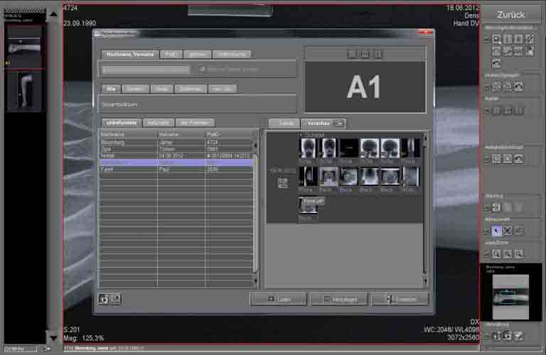 Akquisitions-Befundsoftware-Roentgenbilder-human-6-DE