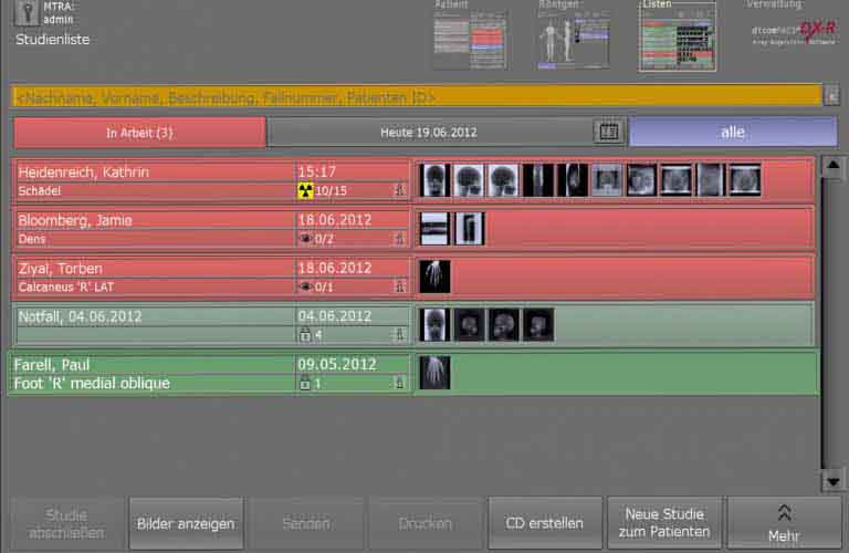 Umfangreiche Suchwerkzeuge ermöglichen den Vergleich von Röntgenuntersuchungen, auch von unterschiedlichen Patienten