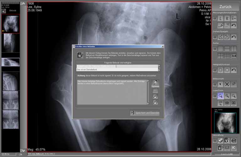 Befunderstellungsmodul in der Akquisitions- und Befundsoftware für Röntgenbilder