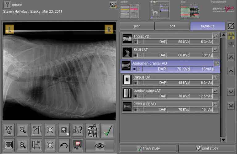 Work list - X-ray image acquisition and diagnostic software