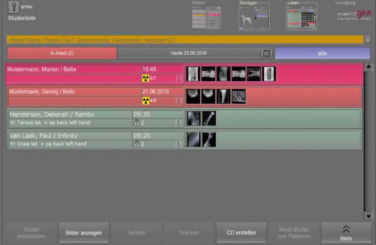 Umfangreiche Suchwerkzeuge ermöglichen den Vergleich von Röntgenuntersuchungen, auch von unterschiedlichen Patienten
