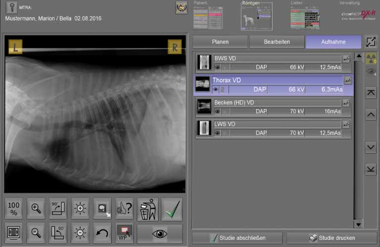 Vorschau der Röntgenaufnahme und Arbeitsliste der Akquisitions- und Befundsoftware für Röntgenbilder