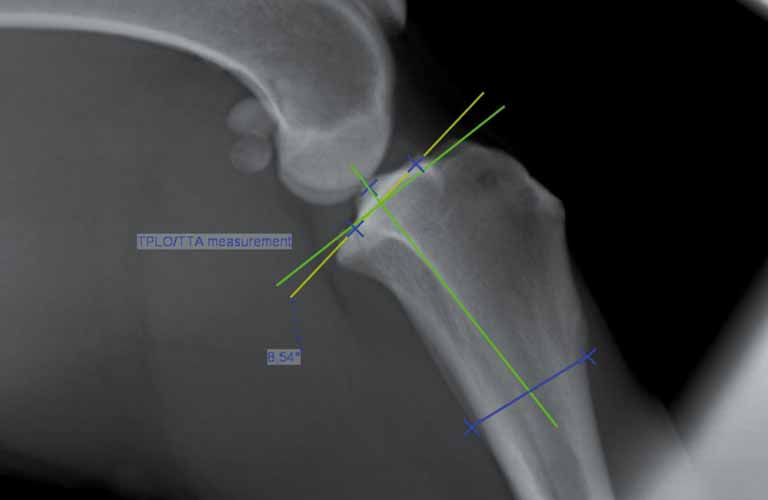 TPLO (Tibial Plateau Leveling Osteotomy): The TPLO  measuring tool helps to  determine the existing slope of the tibial plateau and its theoretical optimization