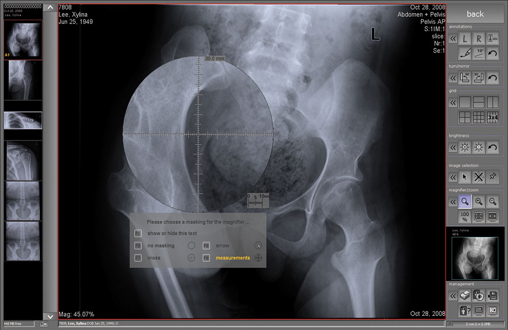 Digital Xray Acquisition and control software for human medicine