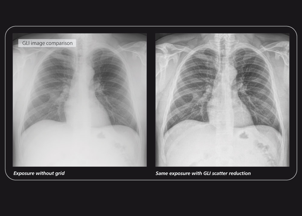 Digital Xray Acquisition and control software for human medicine