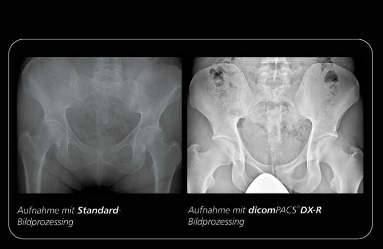 Bildvergleich: Das professionelle dicomPACS DX-R  Bildprozessing