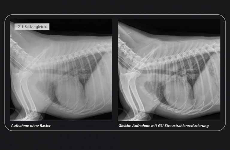 GLI (Gridless Imaging) - Reduzierung der Streustrahlung: professionelle  dicomPACS DX-R Bildprozessing