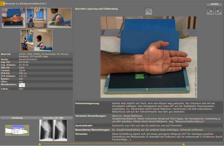 Divario-CR-Tm-digitales-Roentgen-bis-50-human-6-DE