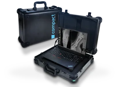 images/Produkte/Leonardo/miniIIIcompact/Leonardo-dr-mini-3-compact-portable-dr-x-ray-system.webp