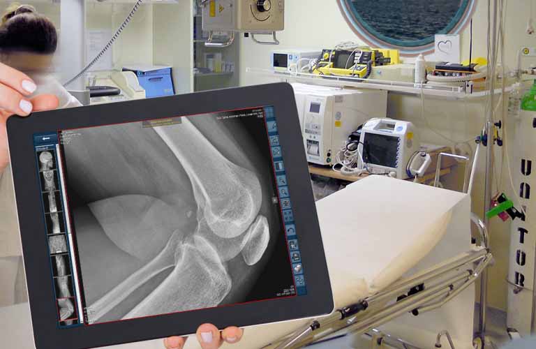 X-ray images and documents can be shared via cloud to obtain a second opinion