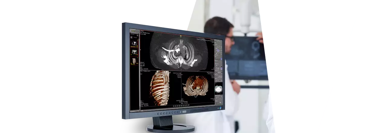 images/Produkte/Pacs/Annotation/sldr-medical-PACS-imaging-software-Annotationen-human-1.webp