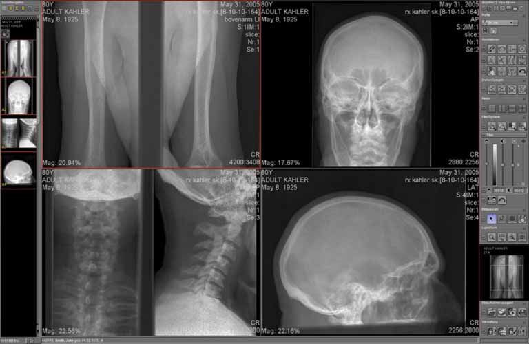 Bildmanagementsystems-dicomPACS-human-3-DE