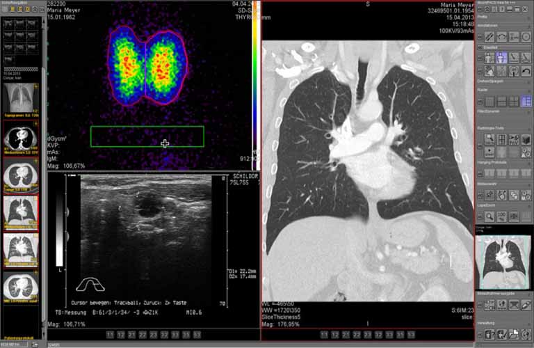 PACS-Software: Spezielle Anpassung für Radiologen - Einfache Integration in ein existierendes HIS oder RIS (DICOM, HL7, BDT/GDT)