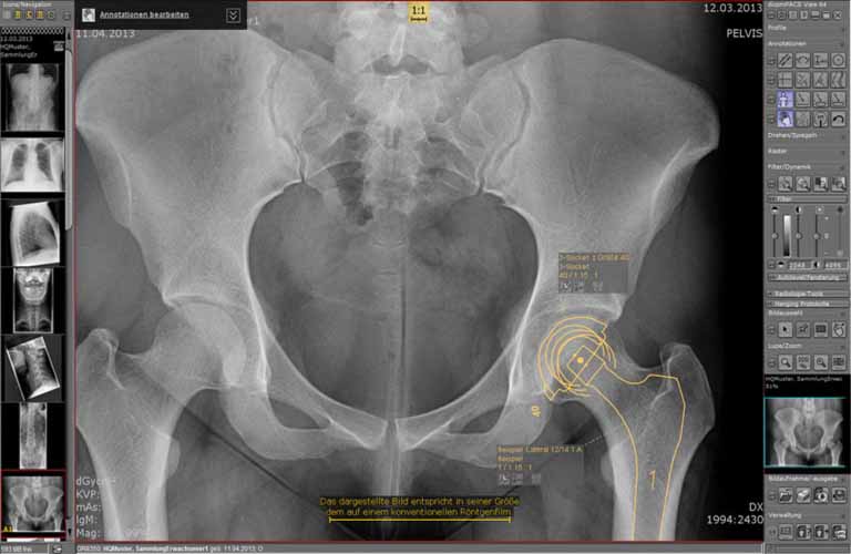 images/Produkte/Pacs/Basis/human/bilder/de/thumbs/Bildmanagementsystems-dicomPACS-human-6-DE_768x500.jpg