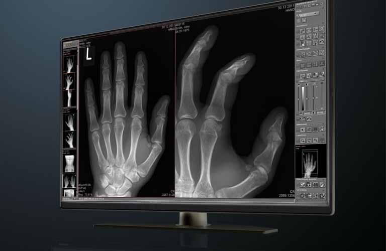 Innovative PACS imaging software solution for radiology practices and hospitals