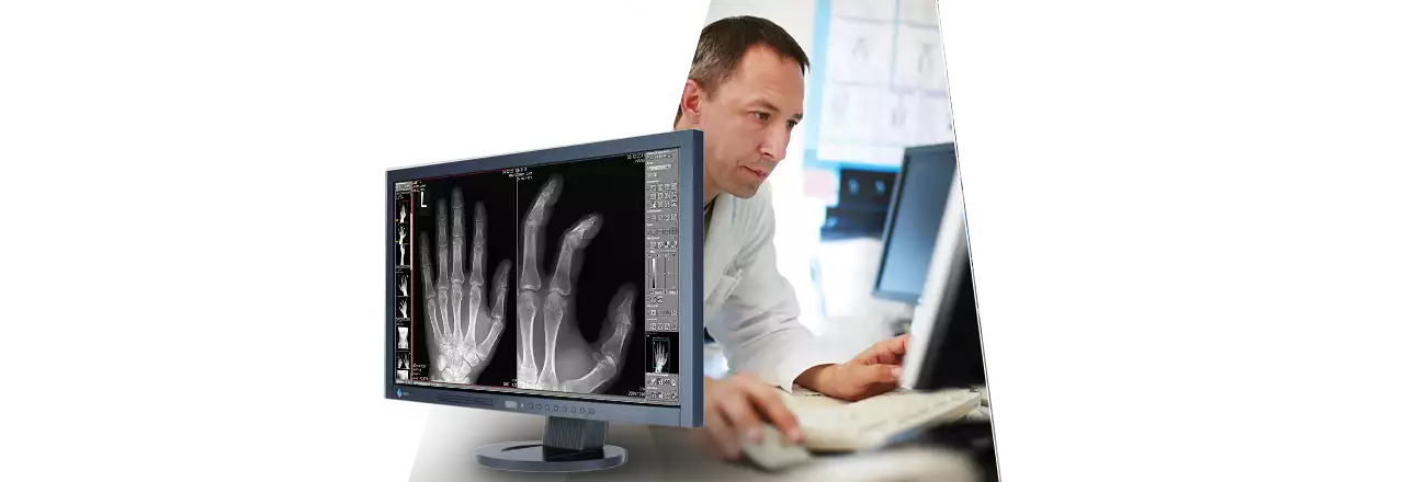 images/Produkte/Pacs/Basis/human/slider/digitales-roentgen-digital-x-ray-PACS-software.webp