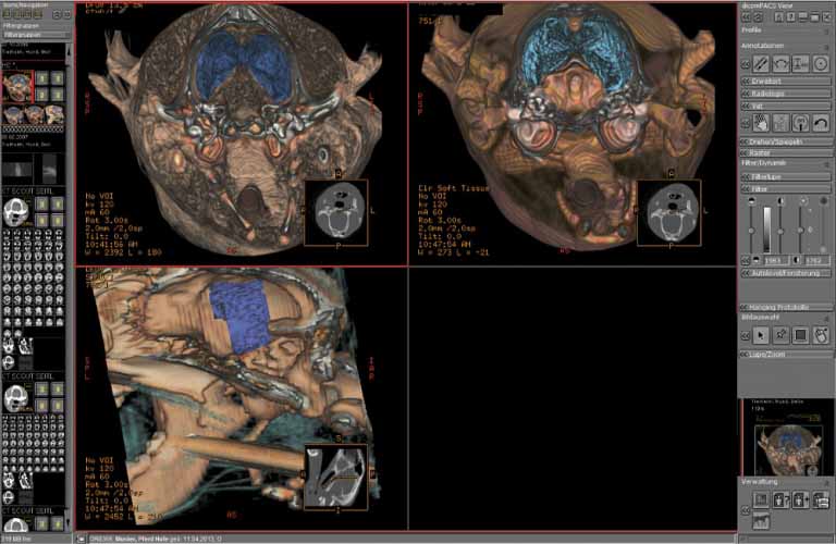 dicomPACS - die Imaging-software für Tierärzte