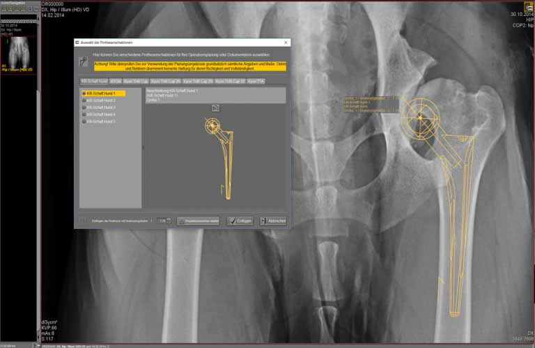 The prosthesis template is transferred to the X-ray image by means of a dicomPACSvet drawing function