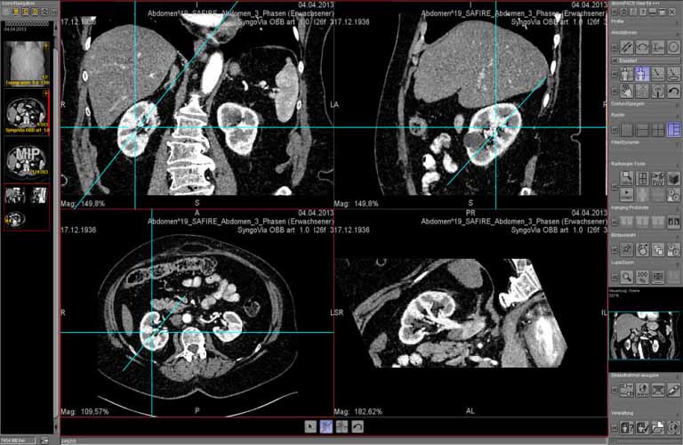 dicomPACS-Scnittbilder-human-2-DEa