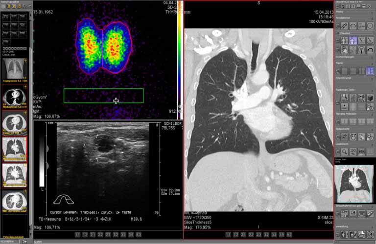 dicomPACS-Scnittbilder-human-3-DEa