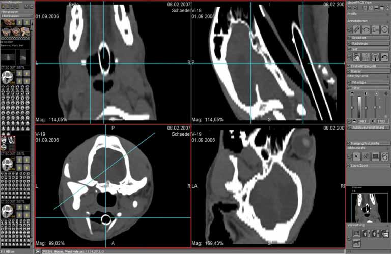 Administration-and-diagnostic-evaluation-of-image-slices-3DE