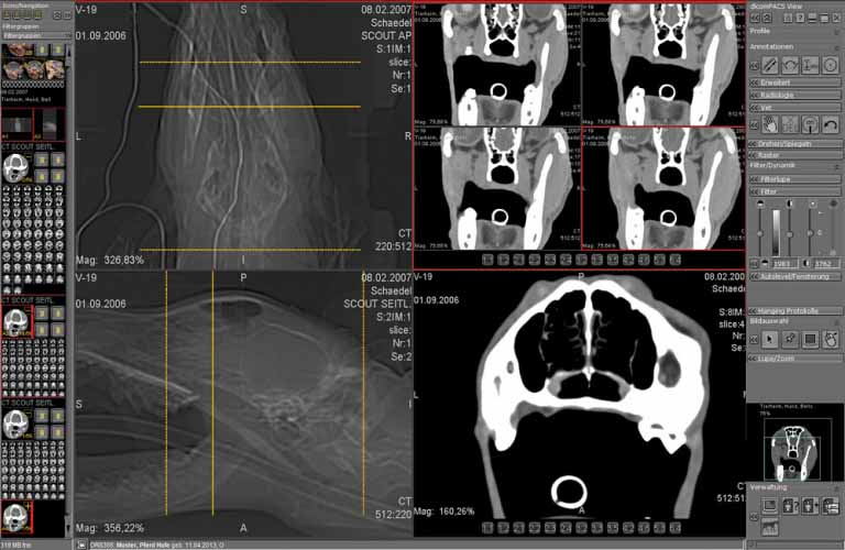 Administration-and-diagnostic-evaluation-of-image-slices-4DE