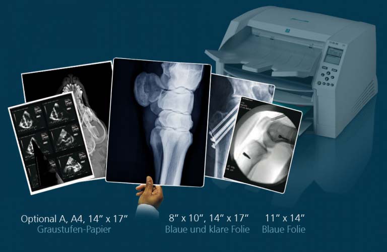 Desktop-Imager für Erstellung medizinischer Filme in diagnostischer Qualität sowie Graustufen-Papierdrucke