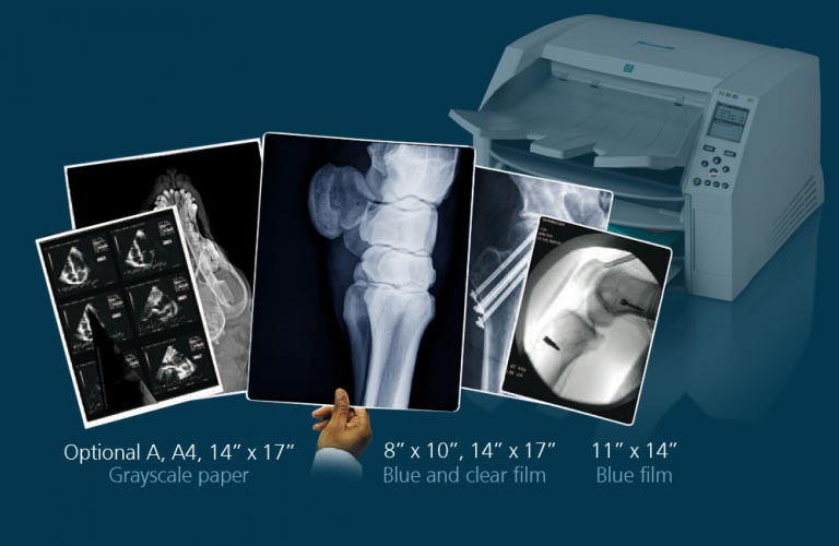  intelligent, desktop dry imager that produces diagnostic quality medical films plus grayscale paper prints if you choose the optional paper feature