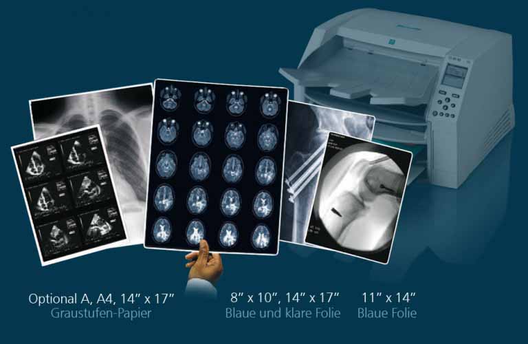 Desktop-Imager für Erstellung medizinischer Filme in diagnostischer Qualität sowie Graustufen-Papierdrucke