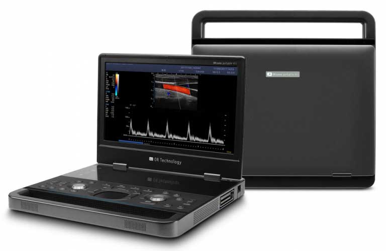 Tragbares Ultraschallsystem für Tierärzte - OR sono portable V11