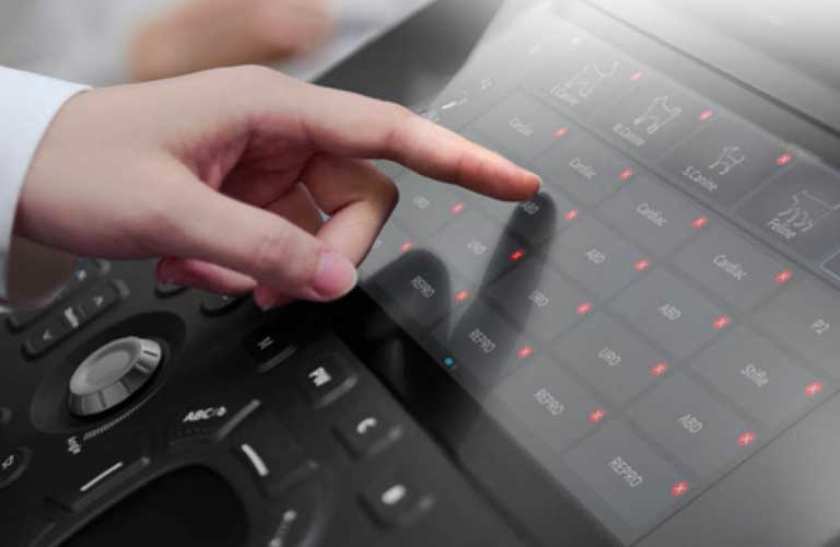 Portables Sonographysystem mit spritwassergeschütztem Touchscreen 
