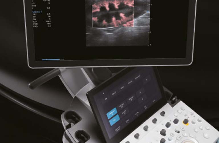 OR sono professional V70 Ultraschallsystem